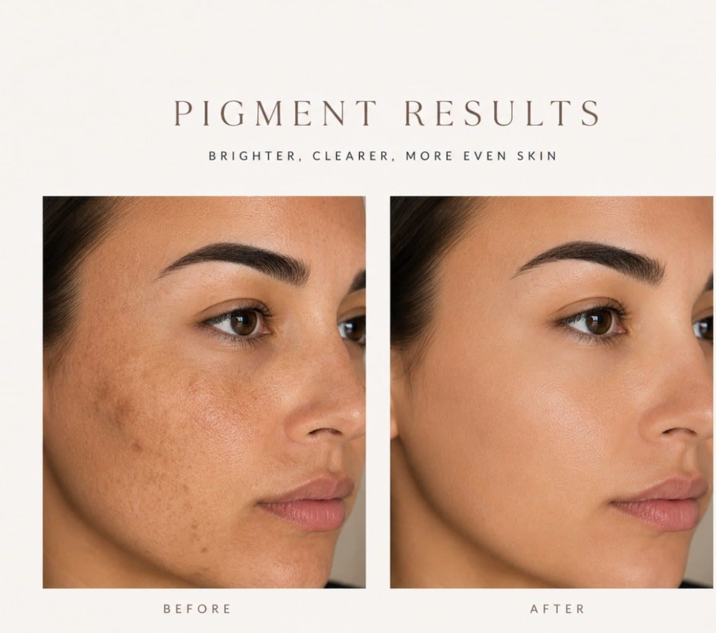 Pigmentation treatment before and after: brighter, clearer, more even skin